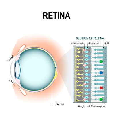 Retinal Issues